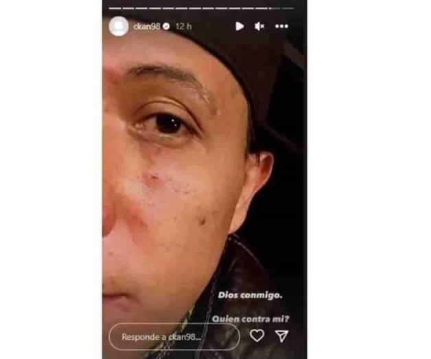 Se accidenta C-Kan en Lagos de Moreno; critica a autoridades