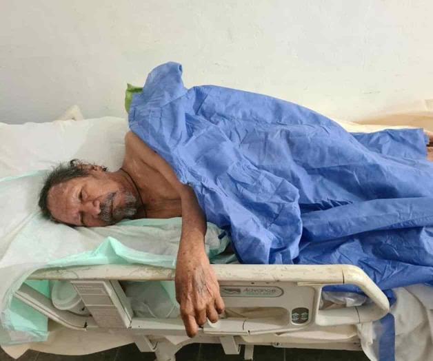 Claman por ayuda para adulto mayor quemado