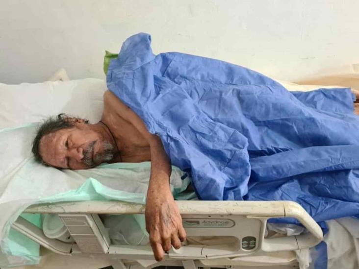 Claman por ayuda para adulto mayor quemado Claman por ayuda para adulto mayor quemado
