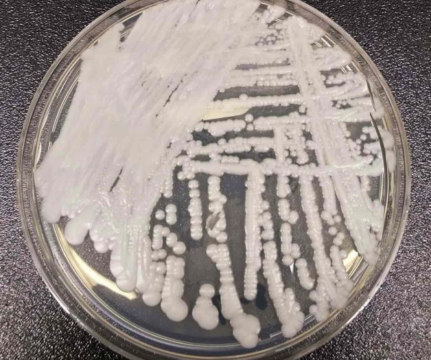 Hongos, un peligro para los enfermos