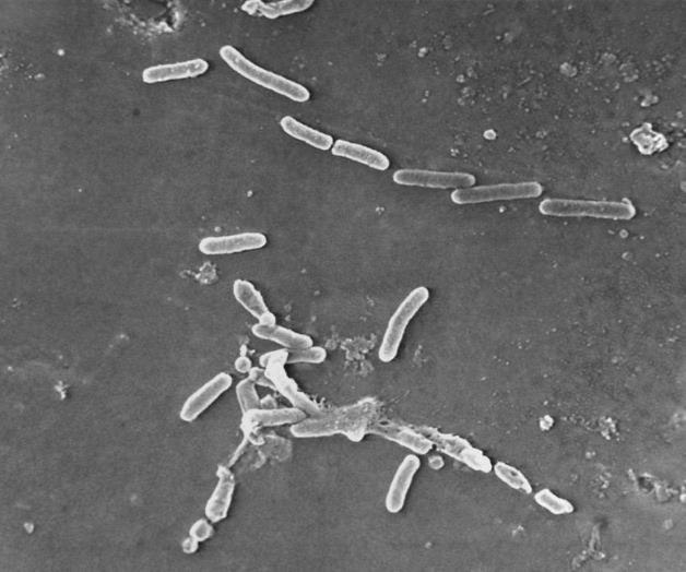 EEUU: Más muertes y lesiones vinculadas con gotas oftálmicas