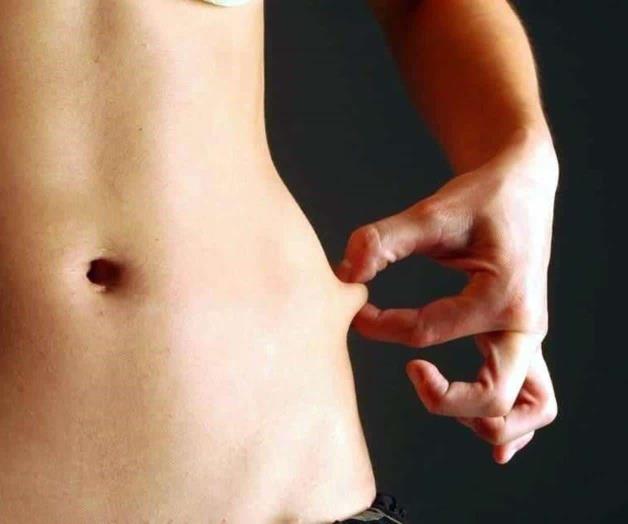 Muere enfermera tras autopracticarse una lipo en Morelos