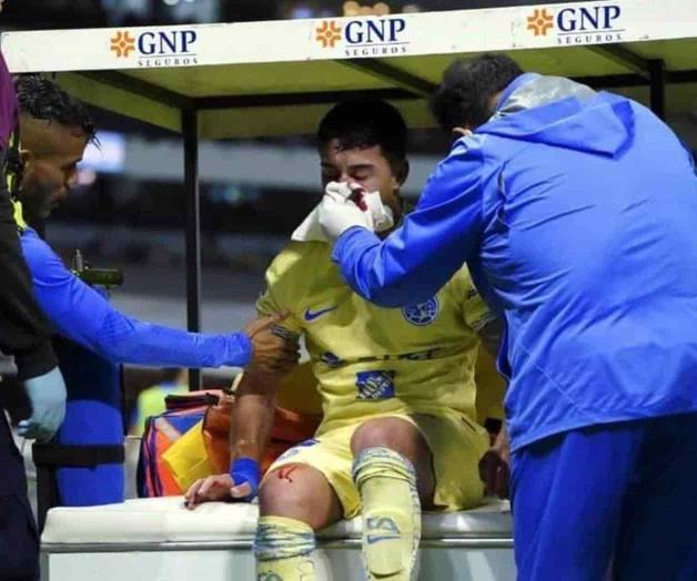 Sufre Zendejas fractura de nariz