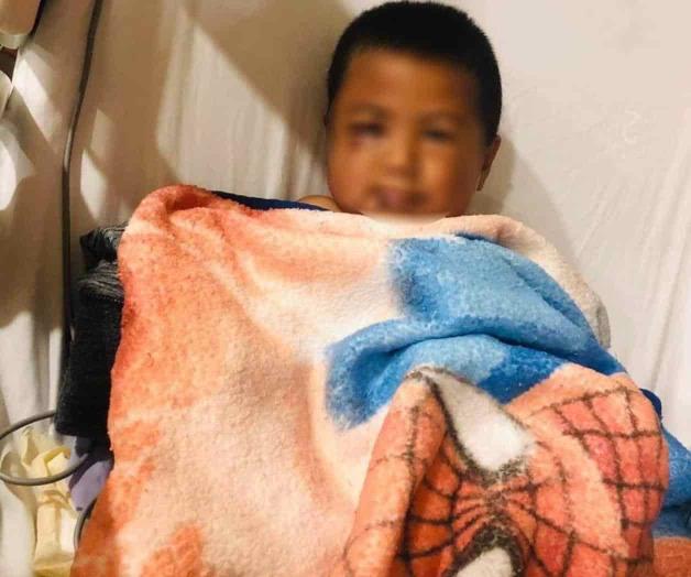 Reportan mejora de Kevin tras caer de juego infantil