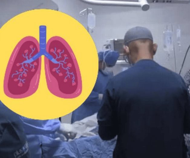 Logran exitosa donación de pulmón en Tamaulipas Logran exitosa donación de pulmón en Tamaulipas