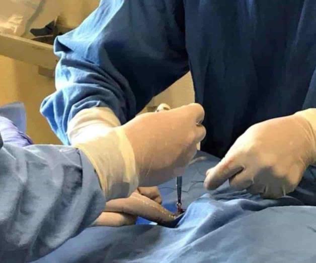 Médico deberá pagar manutención de bebé por error en vasectomía Médico deberá pagar manutención de bebé por error en vasectomía