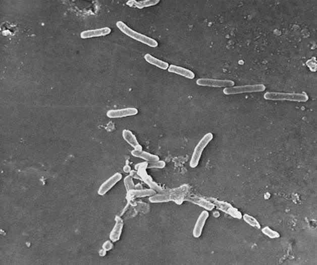 Cuarta muerte por gotas oftálmicas contaminadas