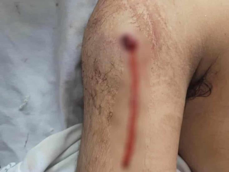 Reportan una nueva víctima de balaceras en la ciudad Reportan una nueva víctima de balaceras en la ciudad