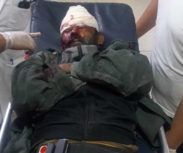 Impacta y lesiona a ciclista; escapa Impacta y lesiona a ciclista; escapa