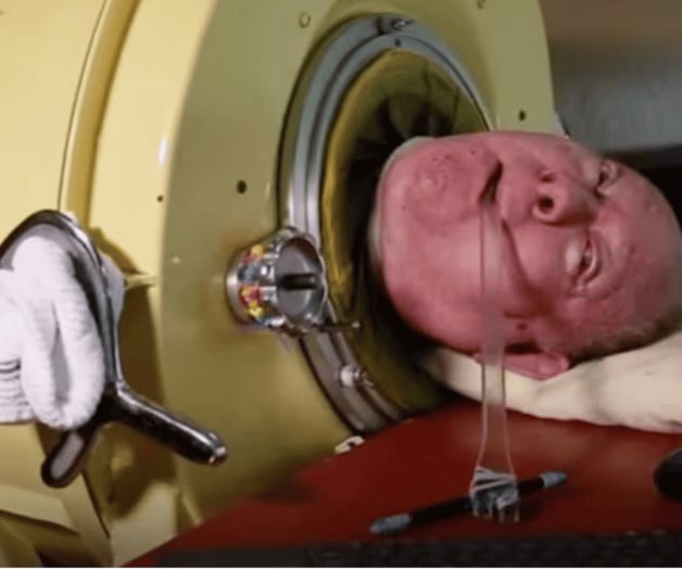 Muere Paul Alexander, el hombre que vivió 70 años en un pulmón de acero