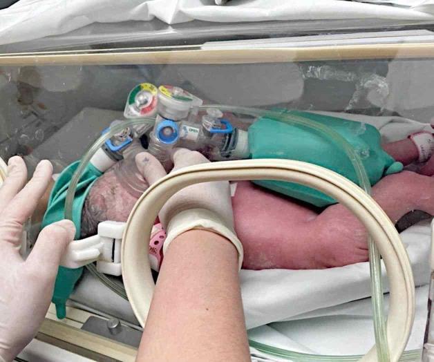 Nacen siamesas; intentarán separarlas