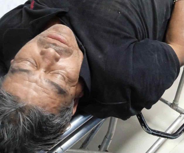 Raro golpe en la cabeza lo mantiene grave Raro golpe en la cabeza lo mantiene grave