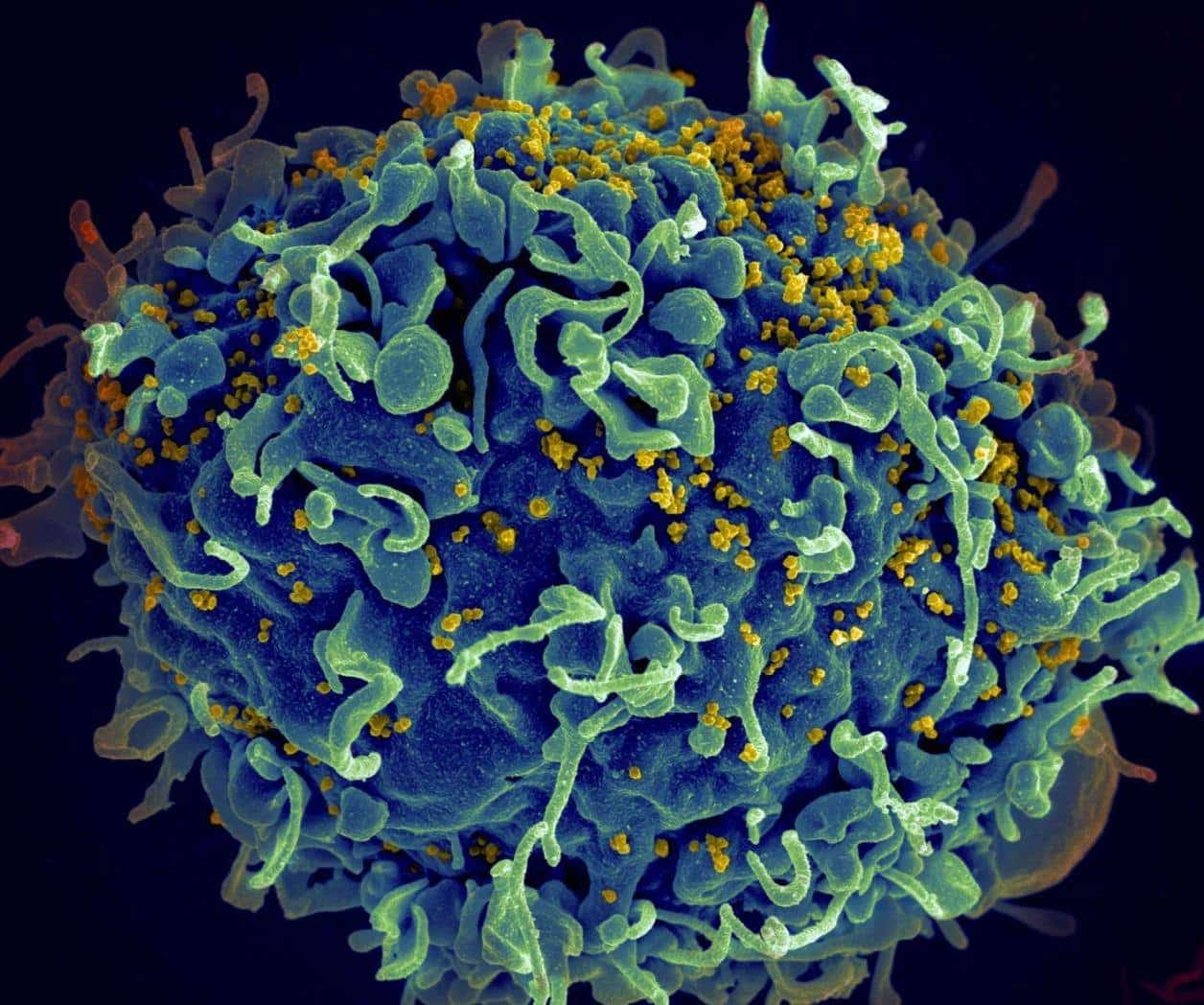 Cada minuto murió una persona de VIH-SIDA