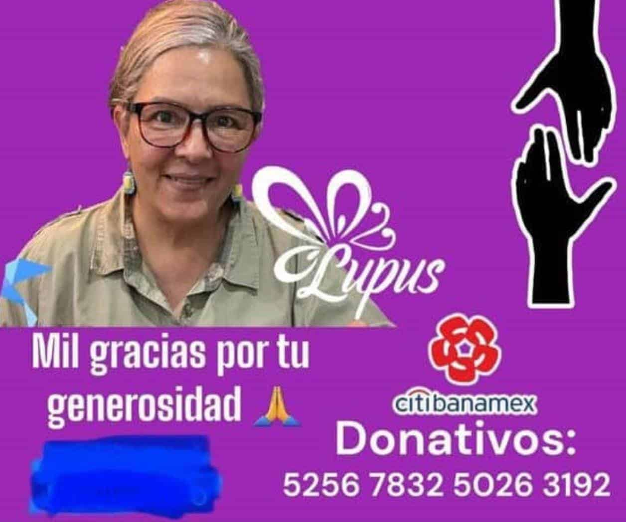 Pide ayuda para  solventar gastos  contra el Lupus