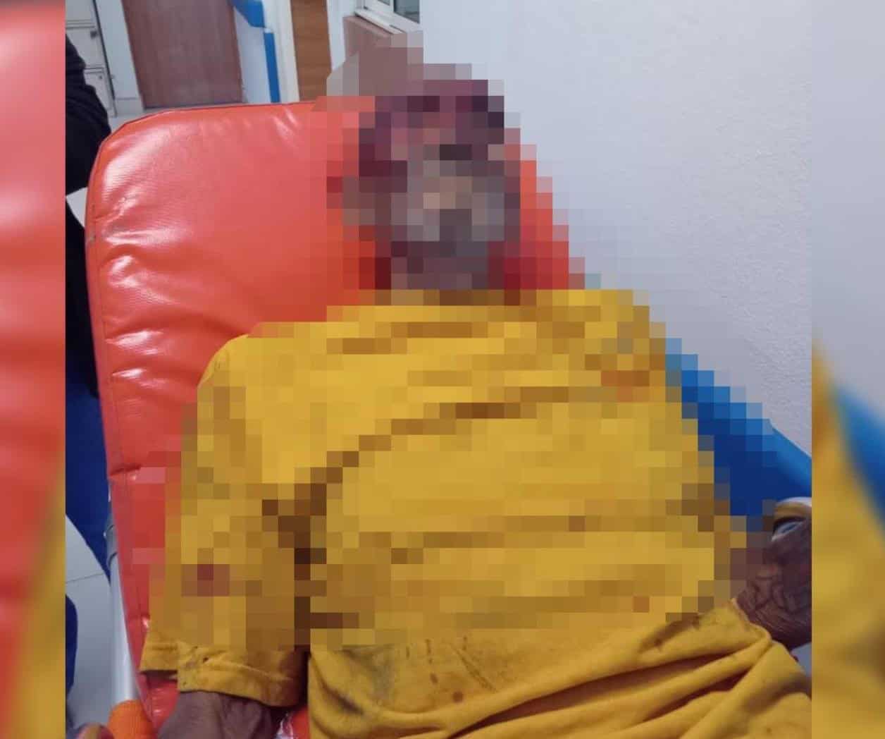 Golpean a un adulto mayor Golpean a un adulto mayor