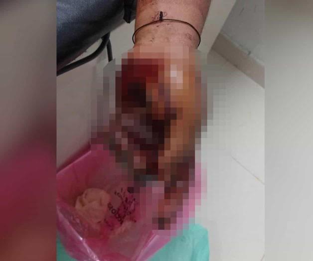 Macheteado por su amigo