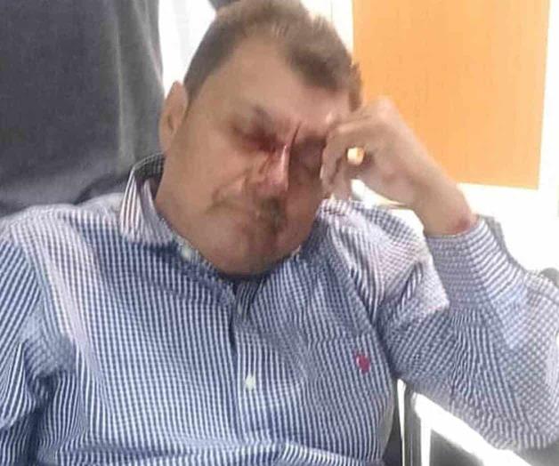 Acaba borrachera en  el Hospital General