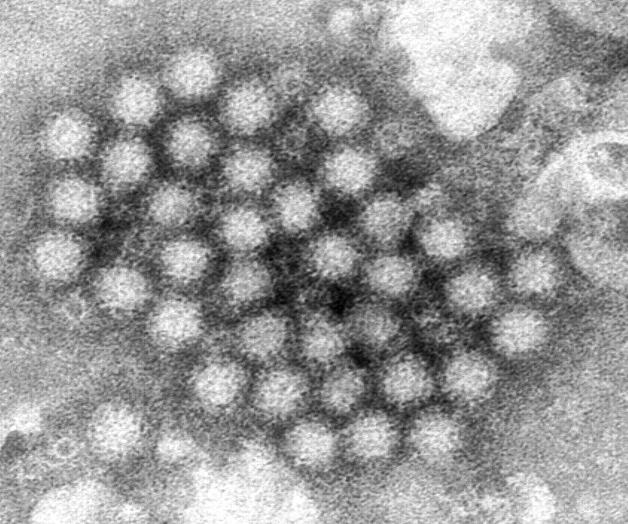 Regresa con fuerza el norovirus en EU Regresa con fuerza el norovirus en EU