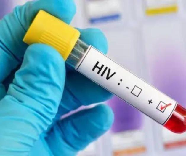 Rechazan el tratamiento infectados con VIH-SIDA Rechazan el tratamiento infectados con VIH-SIDA