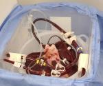 Hígado de cerdo en tratamiento de insuficiencia hepática