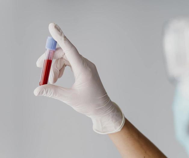 Intensifican pesquisa de casos de VIH-SIDA Intensifican pesquisa de casos de VIH-SIDA