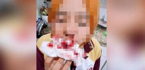 Caso de agresión escolar en Secundaria Núm. 74 de Reynosa
