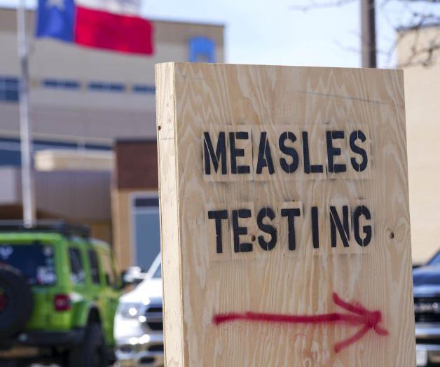 Tiene EU m&aacute;s de mil casos de sarampi&oacute;n