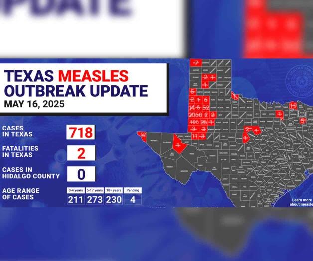 Condado Hidalgo, a salvo:  Confirman un nuevo caso de sarampión