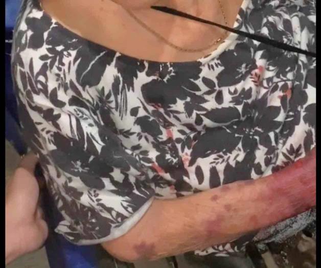 Golpea a su madre por pensión del Bienestar Golpea a su madre por pensión del Bienestar