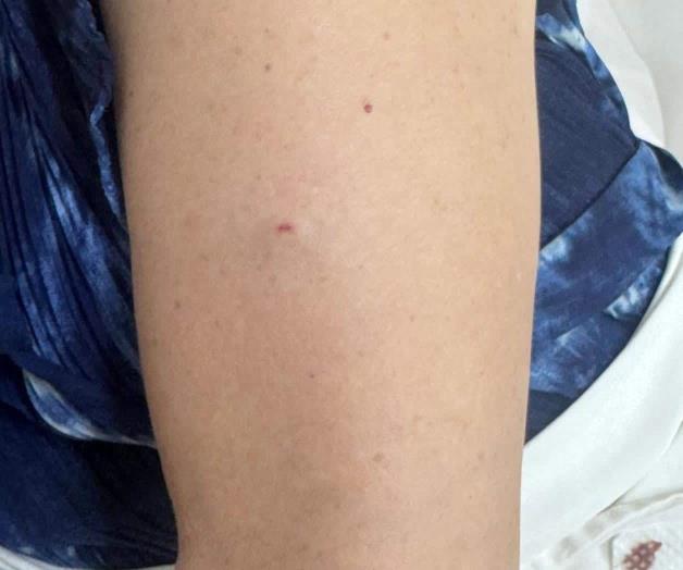 Detectan a mujeres haciendo pinchazos en áreas públicas de Monterrey