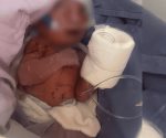 Rescatan a bebé recién nacida abandonada en calles de Ciudad Azteca