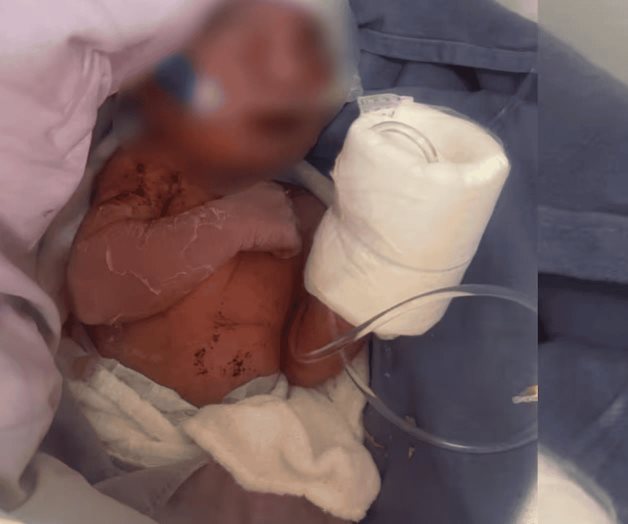 Rescatan a bebé recién nacida abandonada en calles de Ciudad Azteca Rescatan a bebé recién nacida abandonada en calles de Ciudad Azteca