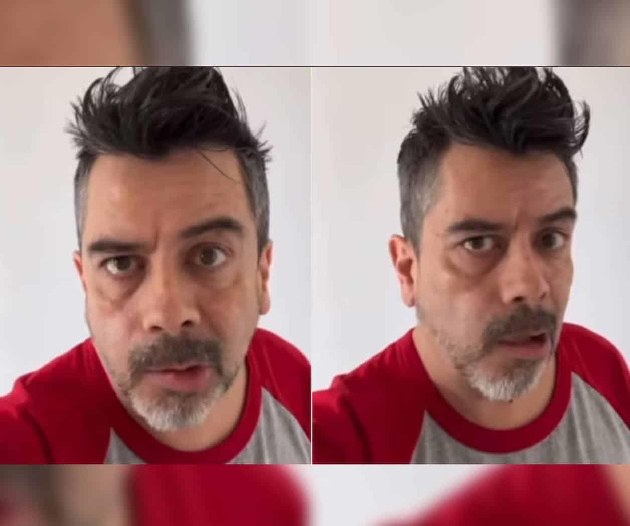 Carlos Espejel reaparece con parálisis facial; atribuye al estrés
