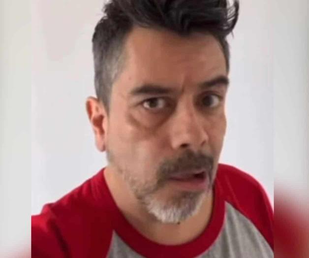 Estrés le causa parálisis facial Estrés le causa parálisis facial