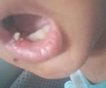 Denuncian caso de negligencia en primaria