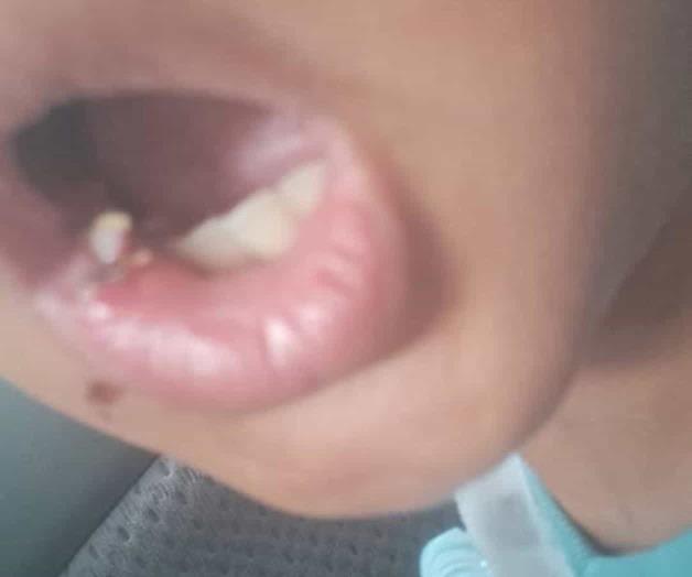 Denuncian caso de negligencia en primaria Denuncian caso de negligencia en primaria