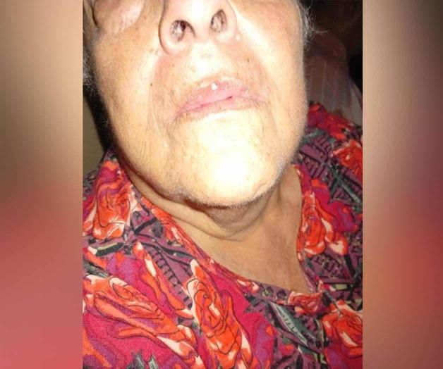 Abuelita acusa ataque de subdirectora escolar