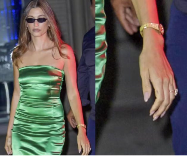 Se divierte sin su anillo de bodas Se divierte sin su anillo de bodas