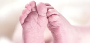 ¿Qué es el Síndrome de Rubinstein-Taybi?; conoce los síntomas