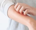 Alertan por enfermedades  de la piel y gastroenteritis