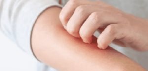Alertan por enfermedades  de la piel y gastroenteritis