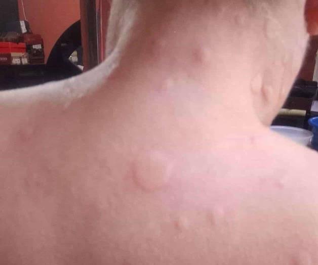 Ataca moscos en la zona poniente