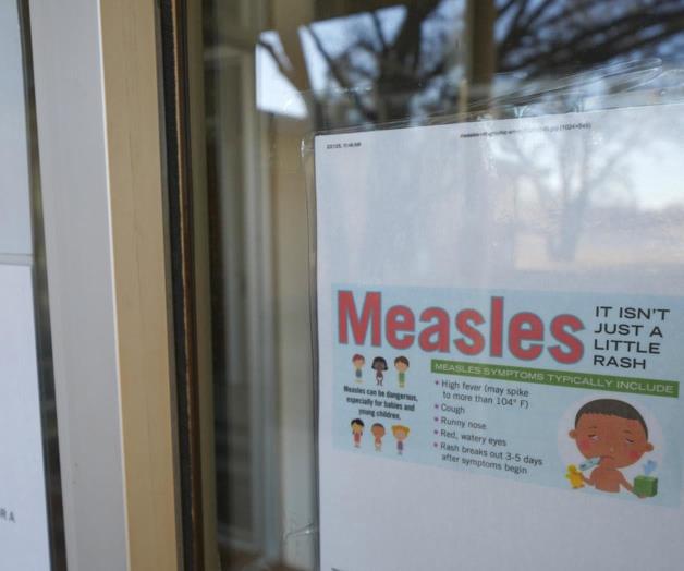 Sarampi&oacute;n en Estados Unidos 2023: Aumentan los casos y brotes