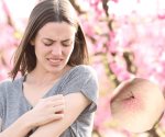 Repelentes naturales para evitar los mosquitos