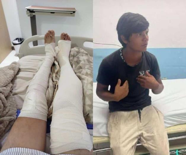 Exige joven atropellado que responsable pague los gastos médicos