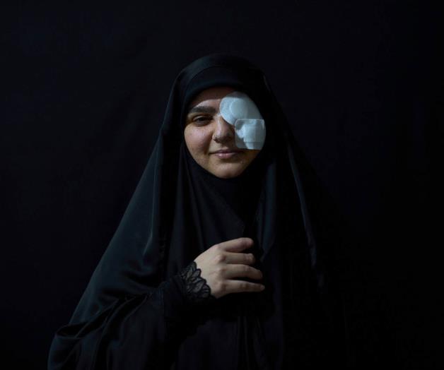 CICATRICES DE GUERRA EN LÍBANO CICATRICES DE GUERRA EN LÍBANO