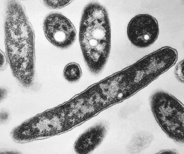 Nueva muerte por brote de legionelosis en Nueva York