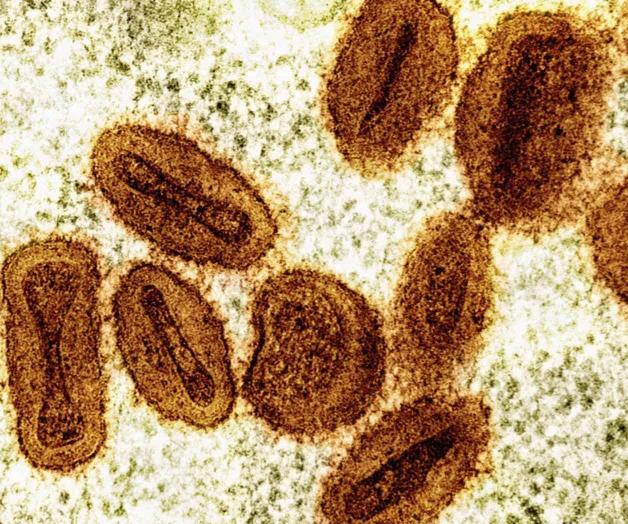 Brote de viruela símica en África ya no es una emergencia de salud global, dice OMS