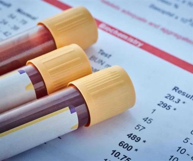 Estalla conflicto en Sedena por estudios de sangre Estalla conflicto en Sedena por estudios de sangre