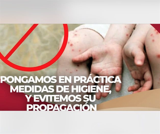 Descarta Salud estatal la alerta epidemiológica Descarta Salud estatal la alerta epidemiológica